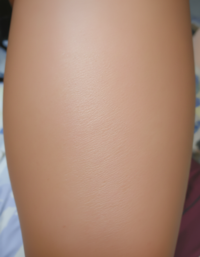 Razor bumps after